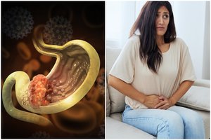 Klastingas vėžys pasireiškia ne iškart: ligą išduoda 8 simptomai