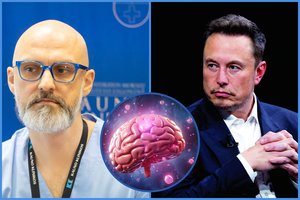 Pasaulinę sensaciją įvertino gydytojas: pildosi E. Musko svajonė nuskaityti žmogaus mintis