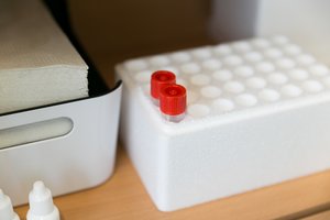 COVID-19 statistika Lietuvoje – 16 koronaviruso atvejų, vienas žmogus mirė