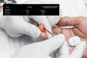 Kraujo tyrimo rezultatai vilnietį išmušė iš vėžių: gydytoja patarė, ką daryti tokiu atveju