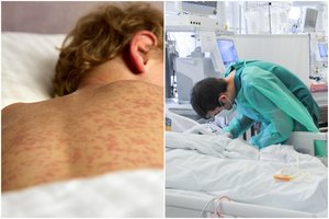 Mirtį Europoje sėja ypač užkrečiama liga: jau plinta ir Lietuvoje