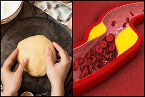 „Riebalai žudikai“: gydytoja dietologė įspėjo – populiarus produktas kemša kraujagysles