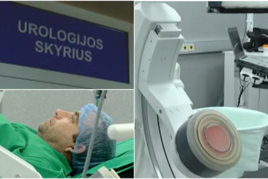 Naujovė inkstų akmenų šalinime: Kaune urologai vienu metu atlieka skirtingas operacijas