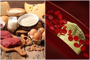 Tyrimas: maistas, kurį daugelis laiko sveiku, gali sukelti aterosklerozę