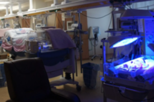 Dviem naujagimiams laiku diagnozuota reta liga leido išgelbėti jų gyvybes