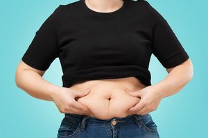 Gyvenimo scenarijus negydant nutukimo: lėtinės ligos – negalia – ankstyva mirtis. Ar yra išeitis?