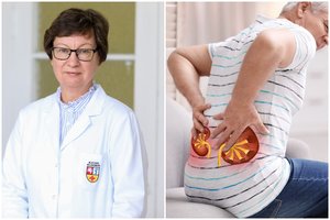 Profesorė: norintiems sveikų inkstų – 8 auksinės taisyklės