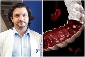 Vyrauja klaidingi įsitikinimai: medikai ragina be baimės tirtis dėl vėžio