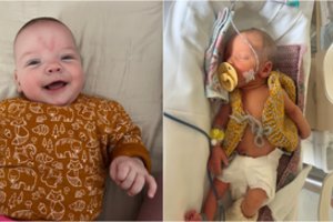 Ankstukės mama Ugnė: neleidau sau verkti, tikėjau ir buvau tikra kovotoja