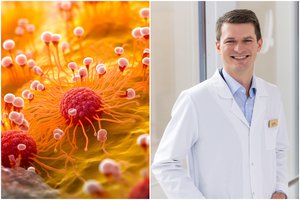 Po pasaulį sukrėtusios žinios – chirurgo įspėjimas: onkologinė liga nesirenka nei pagal amžių, nei einamas pareigas