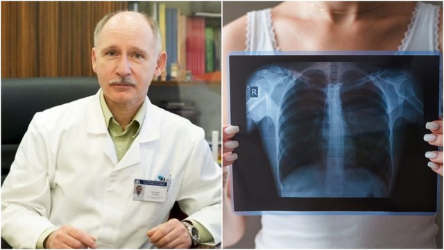Tuberkuliozės pavojai: profesorius įvardijo, kada tikimybė susirgti išauga
