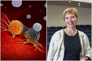 Lietuvos mokslininkų akiratyje – gydymo revoliucija: atrado, kas veiksmingai naikina vėžio ląsteles