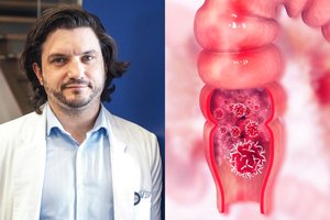 Nuo vėžio apsaugos gydytojo patarimas: šį testą namie atlikti prašo visų, kam daugiau nei 40 metų