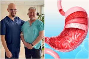 Dingsta refliuksas ir sąnarių skausmai: chirurgas paaiškino, kaip gydo nutukimą