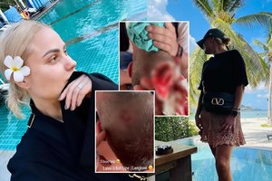 N. Pareigytės-Rukaitienės atostogas aptemdė nelaimingas atsitikimas: vyras atsidūrė ligoninėje