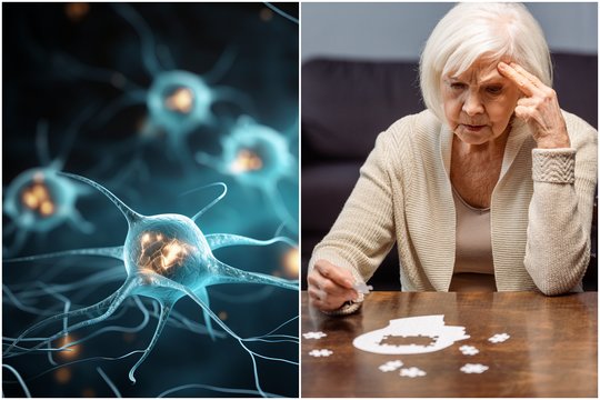 Regėjimo problemos gali būti ankstyvas Alzheimerio ligos požymis.