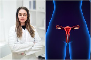 Ikivėžiniai pakitimai gali vystytis lėtai – pasakė, kaip juos pastebėti laiku