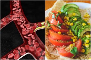 Tyrimas: daugelio pamėgtas vaisius apsaugo nuo ligos, kuri pažeidžia kraujagysles ir sukelia insultą