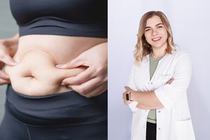 Šeimos gydytoja papasakojo, kokių klaidų nedaryti, norint sėkmingai mesti svorį