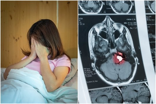 Tik po ilgų ieškojimų medikai pasakė, kad mergaitei diagnozuotas smegenų auglys.
