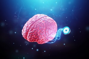 Paaiškėjo, kad „Neuralink“ smegenų implantas buvo patyręs gedimą