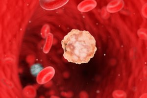 Norite nesirgti vėžiu? Dietologė pataria laikytis 3 taisyklių