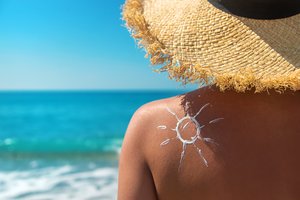 Saulės daroma žala odai: gydytoja atskleidė, kaip nuo to apsisaugoti, ir pateikė alternatyvą