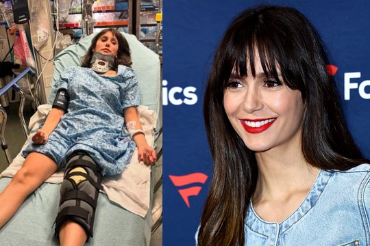 Aktorė Nina Dobrev atsidūrė ligoninėje: pasivažinėjimas virto sunkia trauma.