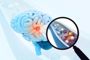 Mokslininkai įtaria, kad šis maistas žaloja smegenų kraujagysles