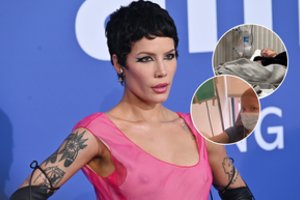Prabilo su sveikatos problemomis kovojanti atlikėja Halsey: „Pasisekė, kad esu gyva“