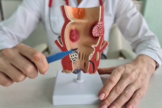 Medicinos proveržis: atrado, kas sukelia nepagydomas žarnyno ligas