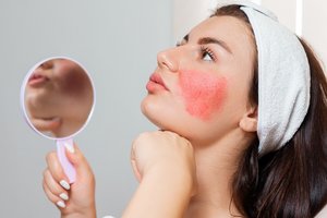 Paraudo veido oda? Gali būti ligos signalas