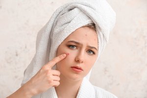 Kas nutiks ant spuogo užtepus dantų pastos? Vaistininkė įspėja – prasta mintis