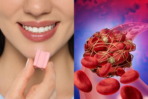 Įspėja, kad kraujo krešulius provokuoja dažnas ingredientas: štai į kokį maistą jo pridėta