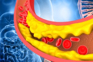 Du zuikiai vienu šūviu: aiškėja, kad populiarus vaistas mažina cholesterolį ir saugo nuo vėžio