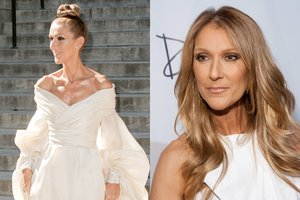 Muzikos žvaigždė Celine Dion papasakojo apie savo gyvenimą su sunkia liga: lūžo šonkauliai