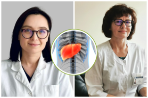 Gydytojos išvardijo, kas užtikrina sklandžią kepenų veiklą, ir pasiuntė įspėjimą dėl maisto papildų