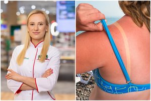 Per daug nusvilote saulėje? Patarė, kaip veiksmingai nuraminti odą