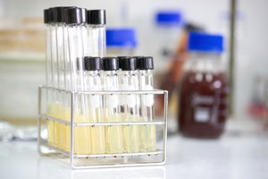 Japonijoje plinta „mėsą ėdanti“ bakterija: užsikrėtęs žmogus miršta per 2 dienas