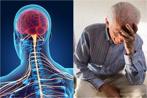 Amerikiečiams trimituojant apie vaistus nuo Alzheimerio ligos – gydytojo žvilgsnis: kodėl Europoje nėra veiksmingo gydymo?