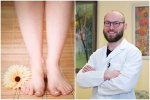 Karštą dieną tinsta kojos? Gydytojas patarė, kaip suaktyvinti kraujotaką