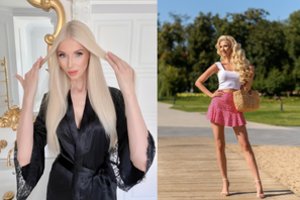 Inga Stumbrienė kreipėsi į sekėjus su pagalbos prašymu: „Man tai pirmas kartas“