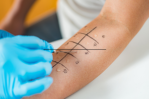 Išsamiai apie vaikų alergijas ir jų sukeliamas ligas kalbanti gydytoja: netiriame to, su kuo mažylis negalėjo susidurti