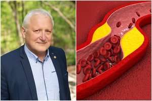Profesorius A. Skurvydas įvardijo, kas valo kraujagyslių sieneles ir gali prailginti gyvenimą 10 metų