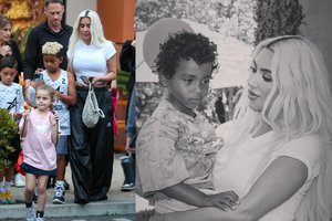 Kim Kardashian prabilo apie odos liga sergantį sūnų: „Tai yra paveldima“