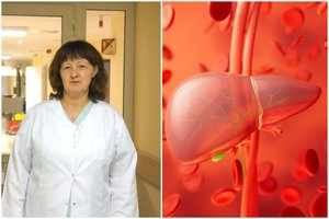 Lietuvoje pradėtas kompensuoti ypač brangus vaistas nuo klastingos ligos