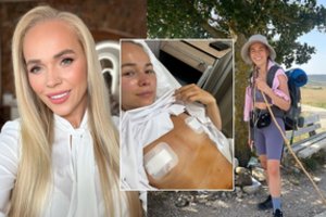 Ieva Voveris atsidūrė ant operacinės stalo: plyšus krūties implantui grįžo prie natūralumo