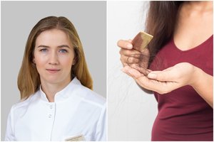 Gydytoja patarė, kaip prižiūrėti plaukus vasarą: padės išlaikyti žvilgesį ir apsaugos nuo slinkimo