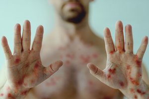 PSO gali paskelbti naują, mirtiną viruso protrūkį tarptautine nepaprastąja padėtimi