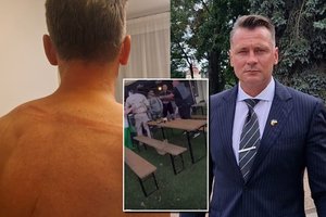 Po A. Paltaroko užpuolimo – organizatorių atsakas: „Nereikėjo vaidinti“